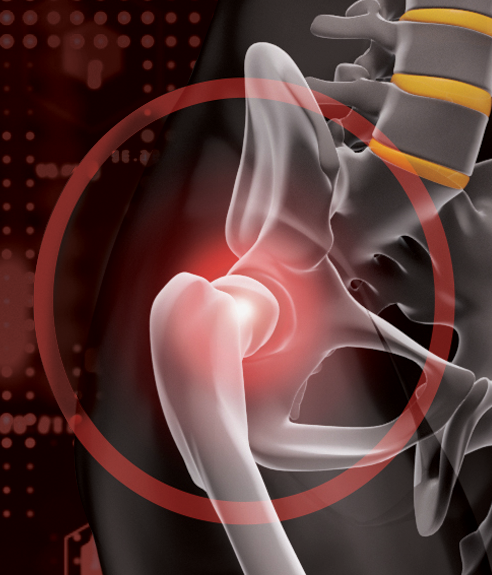 Hip Pain Specialists | Youngstown Orthopaedic Associates