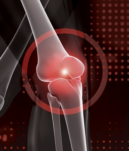 Knee pain treatment