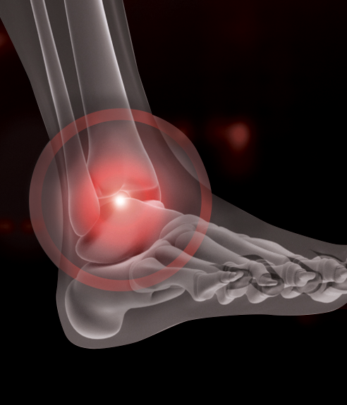 Foot & Ankle | Youngstown Orthopaedic Associates